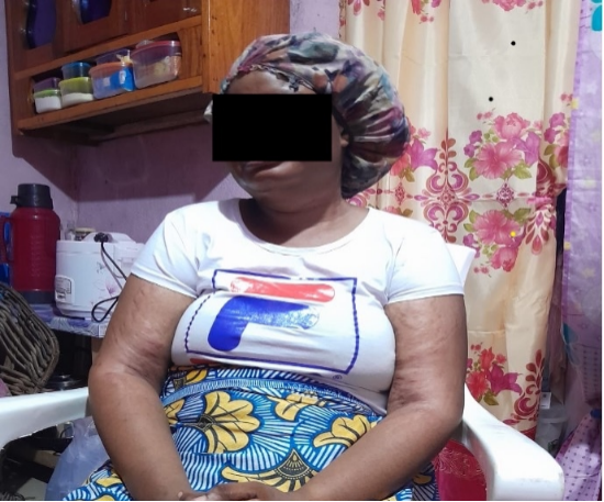 Liberian Government Relocates Rape Survivor Family Over Safety Threats