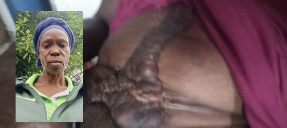 Liberia: Government Compelled to Set Payment Date as JFK Medical Negligence Case Deepens Amid Court Defiance and Patient Suffering